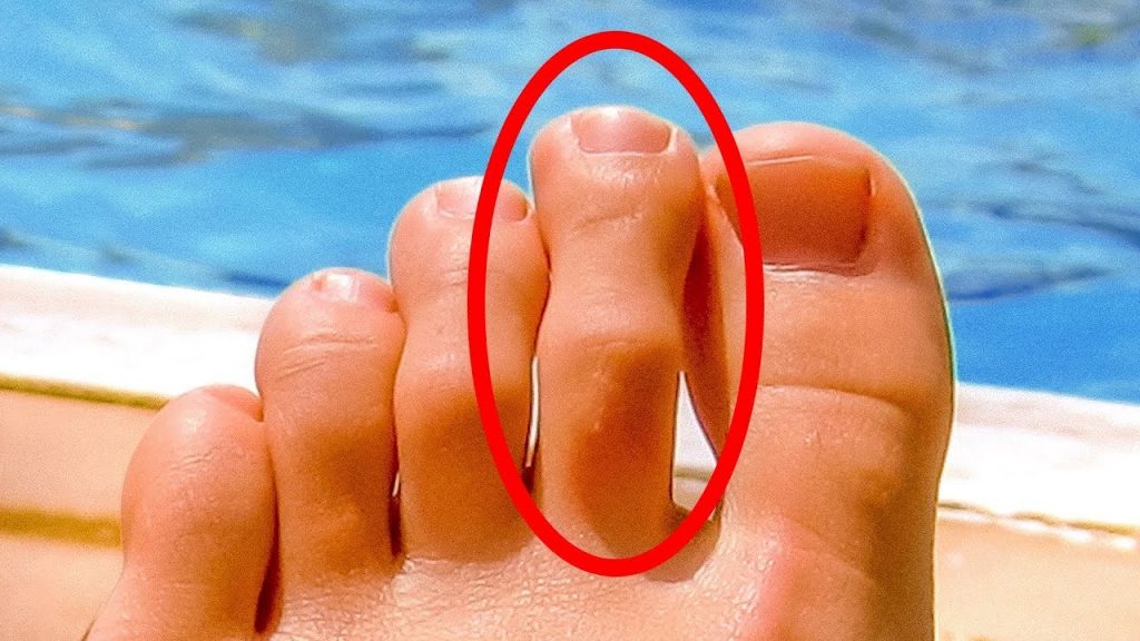 Toe Crying 8 SIGNS THAT YOUR BODY IS CRYING FOR HELP – My WordPress Website