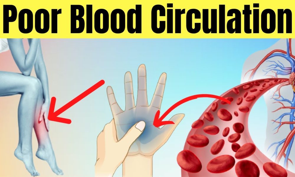 Do You Suffer From Poor Circulation? Here’s How To Solve The Problem In ...